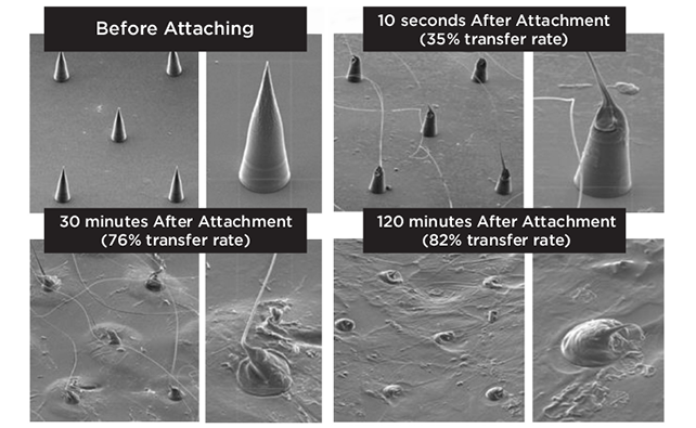 microneedle